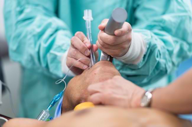 Kapan Harus Melakukan Pemasangan Intubasi Endotrakeal?